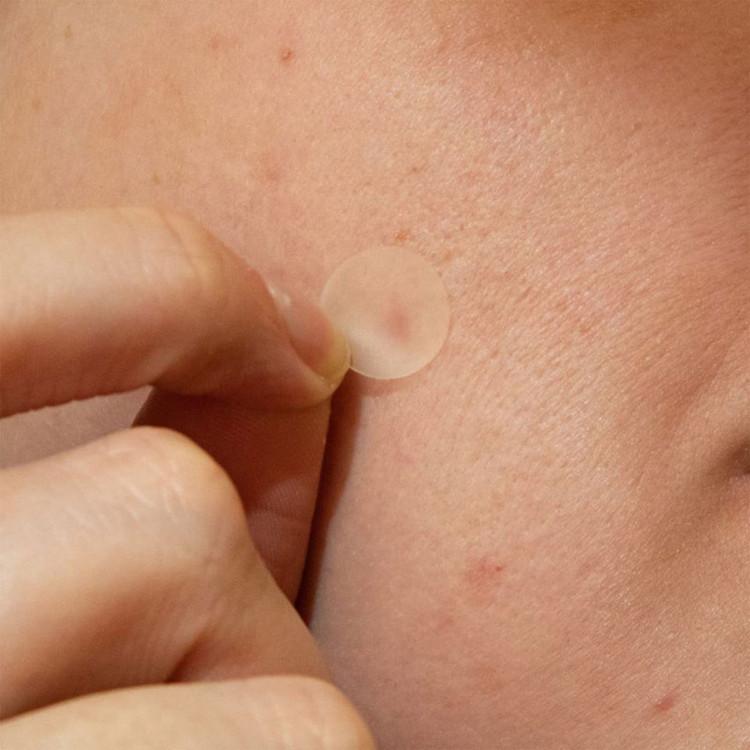 چسب ضد جوش پنرول مدل PRD Acne Cover Patch 360 بسته 36 عددی