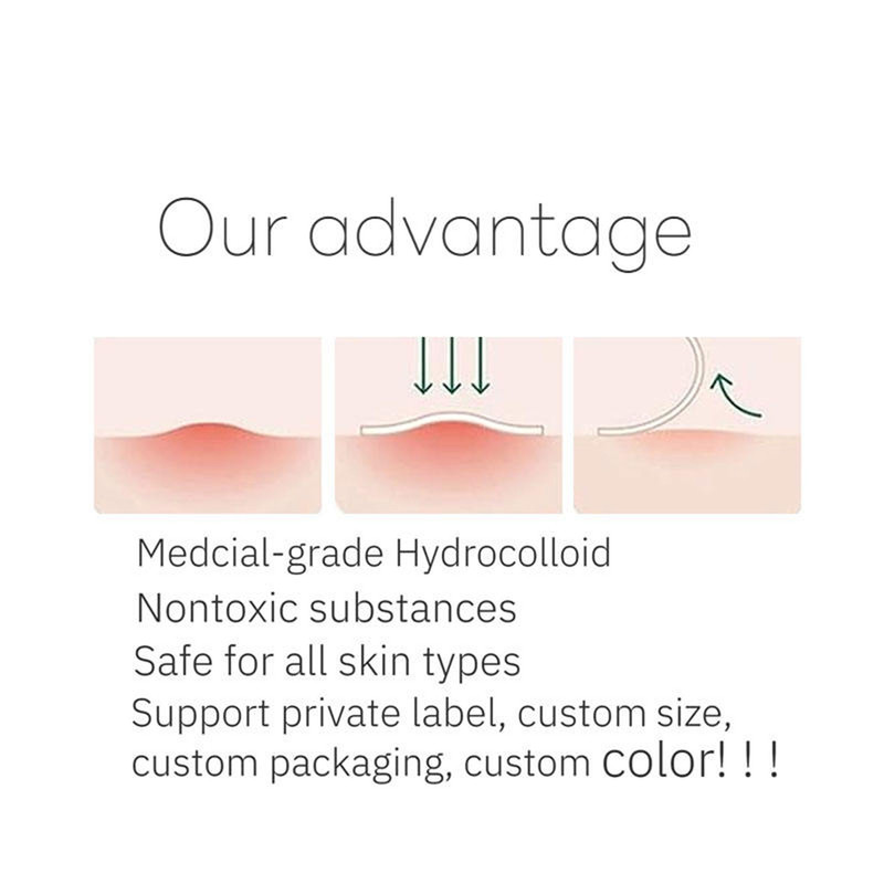 چسب ضد جوش پنرول مدل PRD Acne Cover Patch 360 بسته 36 عددی