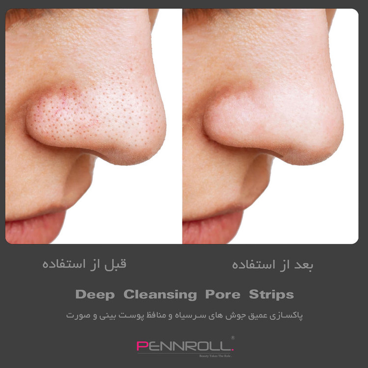 چسب پاک کننده بینی پنرول مدل PRD - Deep Blackhead Acne Cleanser مجموعه 9 عددی